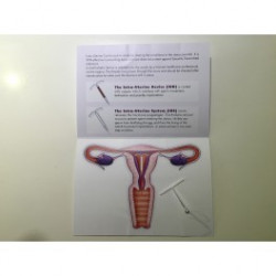 IUS/IUD plastic model and mini booklet